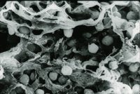 胸腺の電子顕微鏡写真