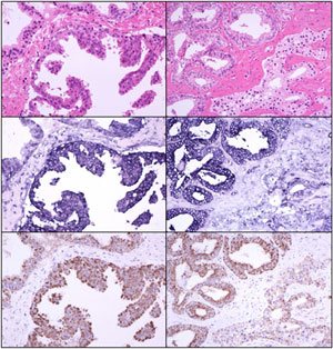 Prostate, 54:187-193, 2003.